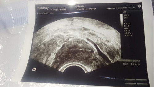 Mimpi disuruh minum air do'a