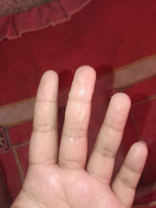 ตกขาวแบบนี้เกิดจากอะไรคะ