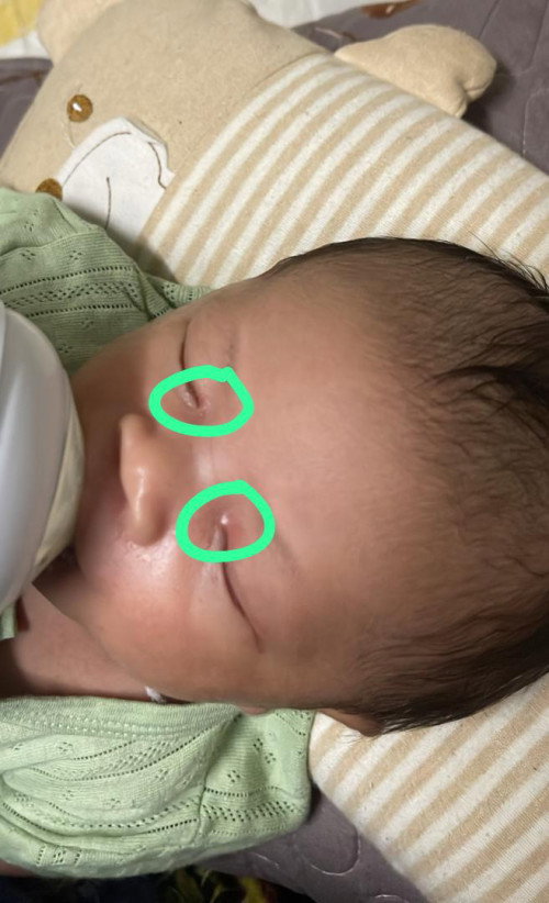 tepi mata baby merah