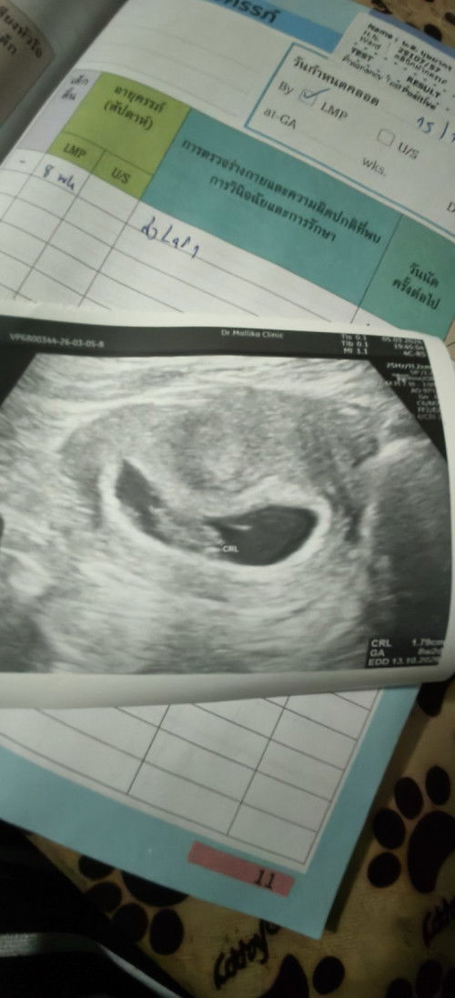 ต้าวจิ๋วน้อย