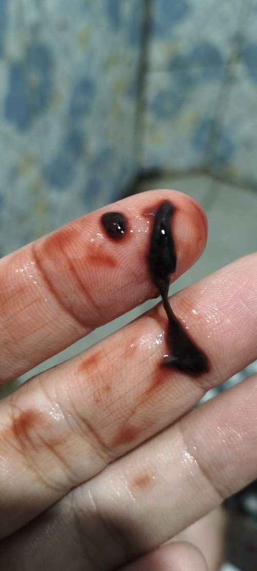 Flek sejak 22w-25w3d