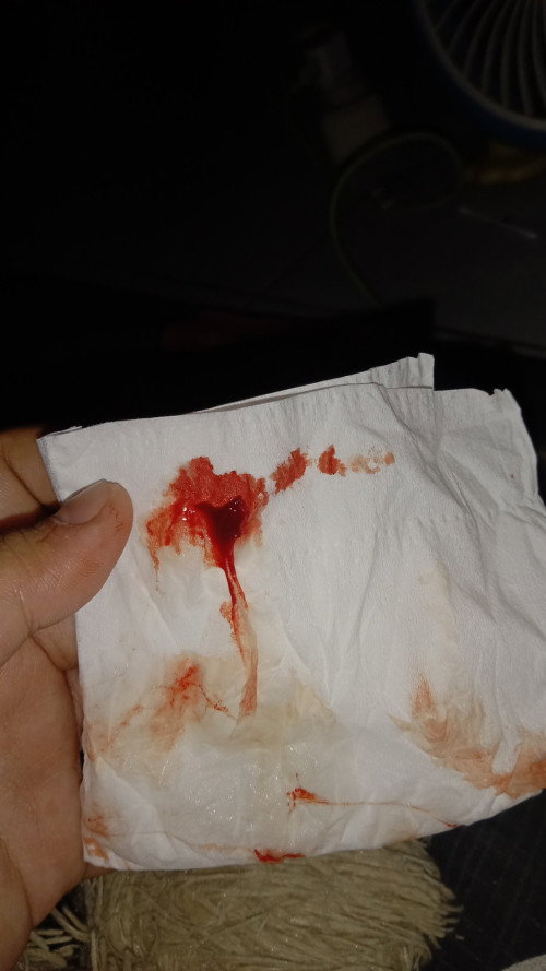 Usia 8 Minggu tiba2 keluar darah seperti itu apakan ini keguguran