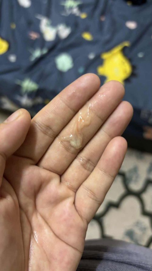 Lendir putih campur sikit darah