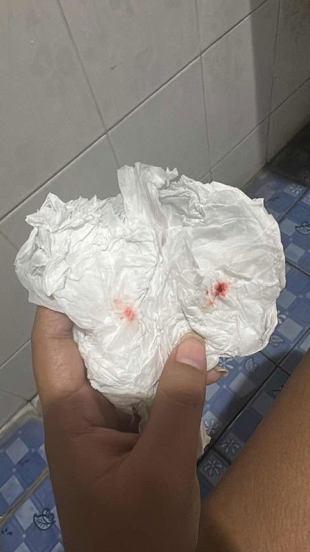 ท้อง6เดือนมีเลือดออกอันตรายไหมคะ
เลือดออกแค่ในภาพค่ะ มีอาการปวดท้องด้านล่างข้างนิดหน่อยด้วยค่ะ