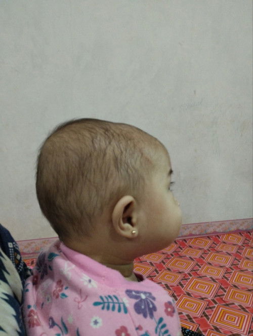 LK 40,5 diusia 6 bulan