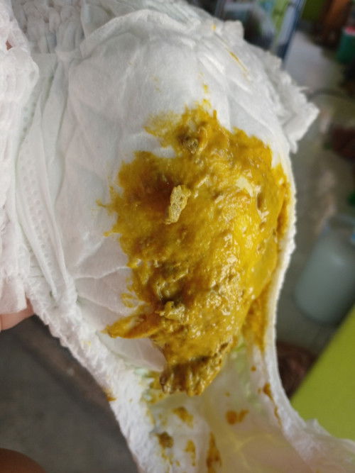 อาการอึน้องเป็นแบบนี้ปกติไหมคะ