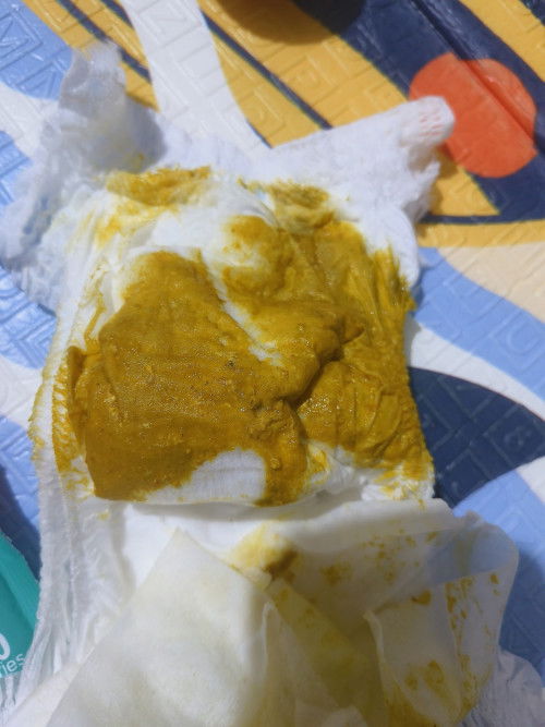 Bayi 6 bulan kembung dan BAB terus