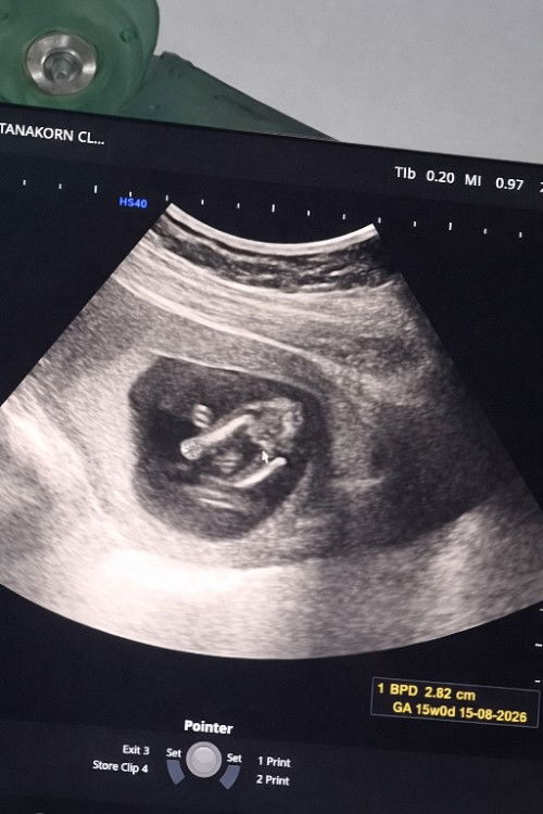 แม่ ๆ ช่วยเดาหน่อยค่ะ ลักษณะแบบนี้ลูกชายหรือลูกสาว