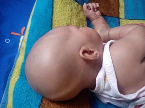 หัวแบบนี้คือปกติมั้ยคะ