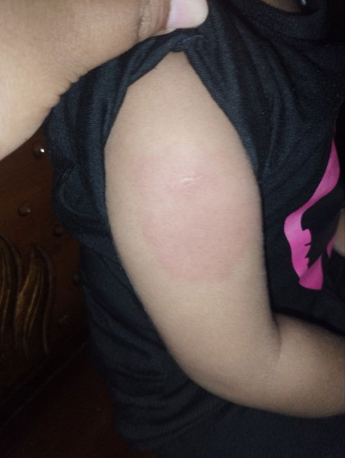 DPT LANJUTAN 18 BULAN