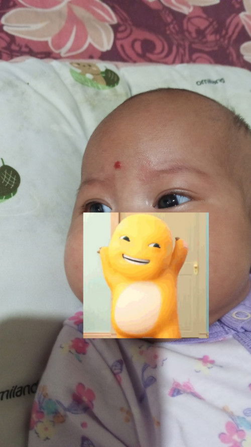 Bekas Gigitan Nyamuk