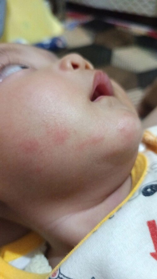 cream apa yg bagus buat ilangin