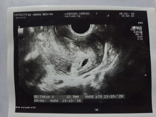 Halo ini kehamilan di dalam rahim atau luar rahim ya help me