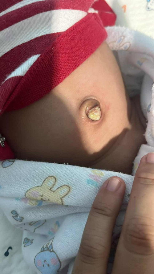 แบบนี้ต้องไปหาหมอมั้ยคะ