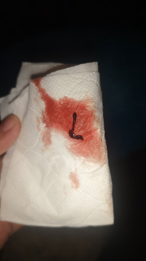 Keluar darah di kehamilan 9week