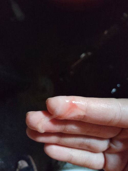 25 weeks pregnant red spotting