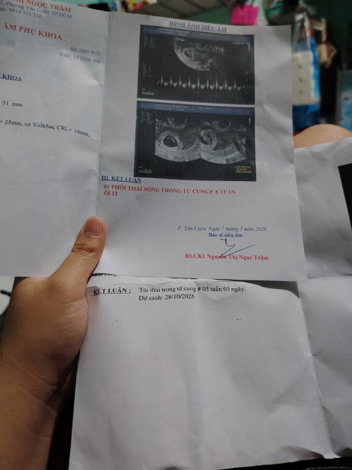 Siêu âm nào chuẩn các mom
Sieu đầu dò và ssieu âm bụng
Trong giấy là mình sieu cách nhau 1uan