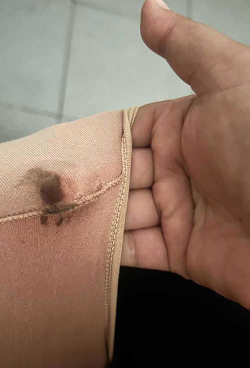 ตกขาวสีน้ำตาล