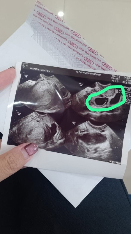 Bagaimana yang dapat disimpulkan dari hasil gambar tersebut?