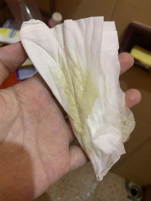 Keputihan disertai kluar air