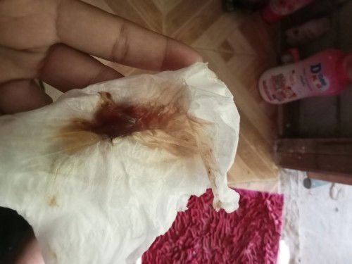 มีหมูกเลือด