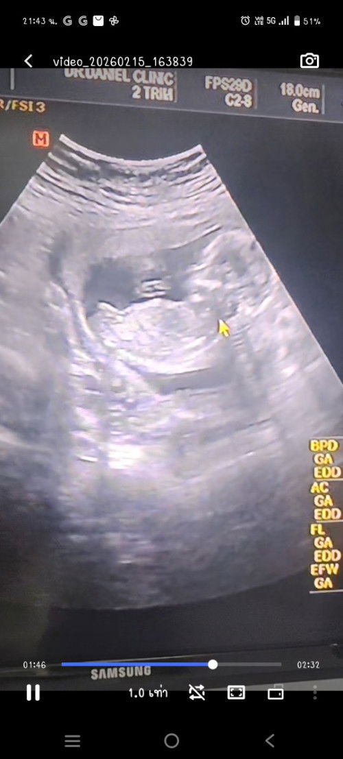 แบบนี้แม่ๆว่าน้องเพศอะไรคะ