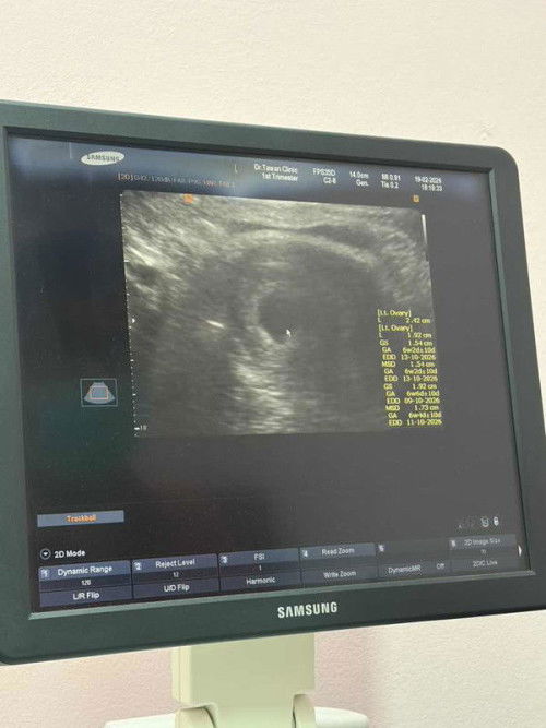 มีโอกาสจะเจอตัวน้องมั้ยคะ