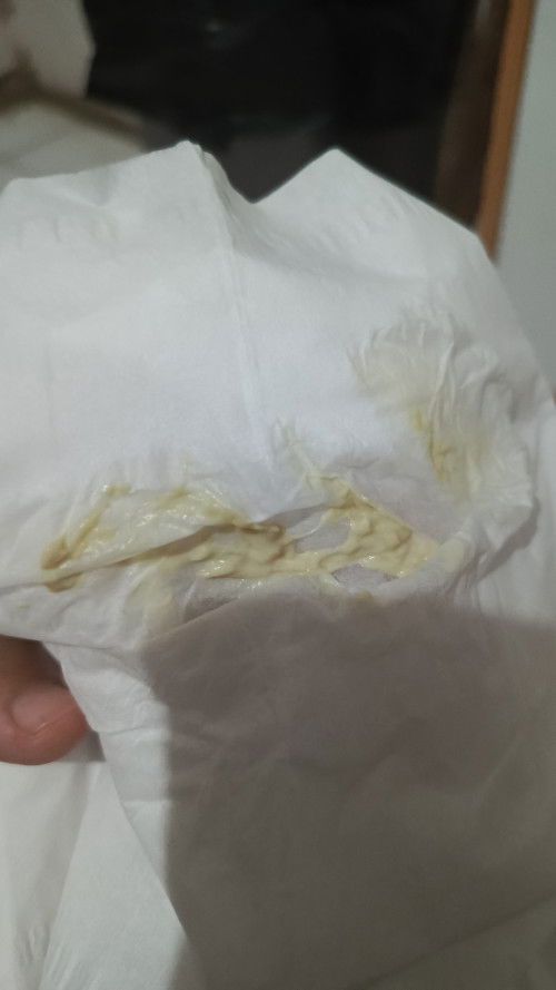 Bun mau tanya ini keputihan atau keputihan mendekati lahir ya bun, usia kandungan 38,tidak gatal