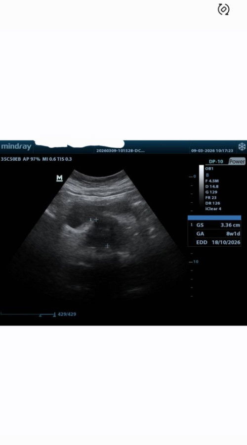 8weeks periksa di klinik oleh dokter umum