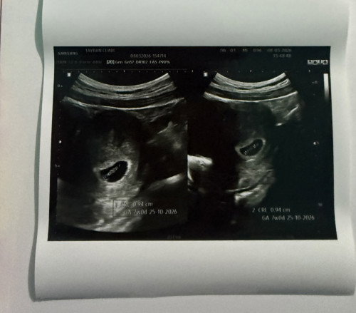 ฝากท้องสมุทรปราการ

ฝากท้องหมอวีรวัฒน์ปากน้ํา