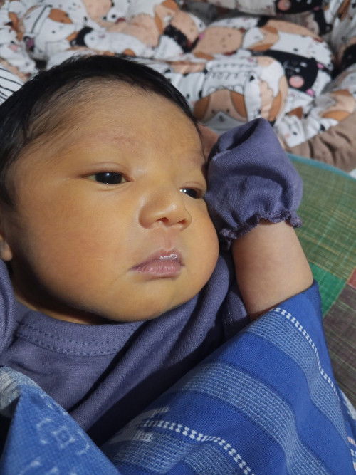 Bayi kuning baru umur 6 hari