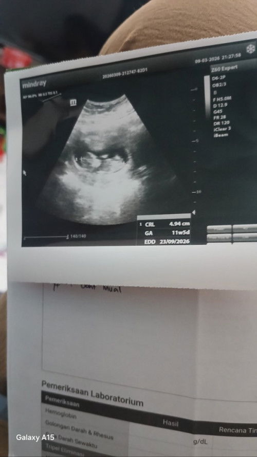 Kata Dr Obgyn Normal, tapi aku ko overthingking ya bun