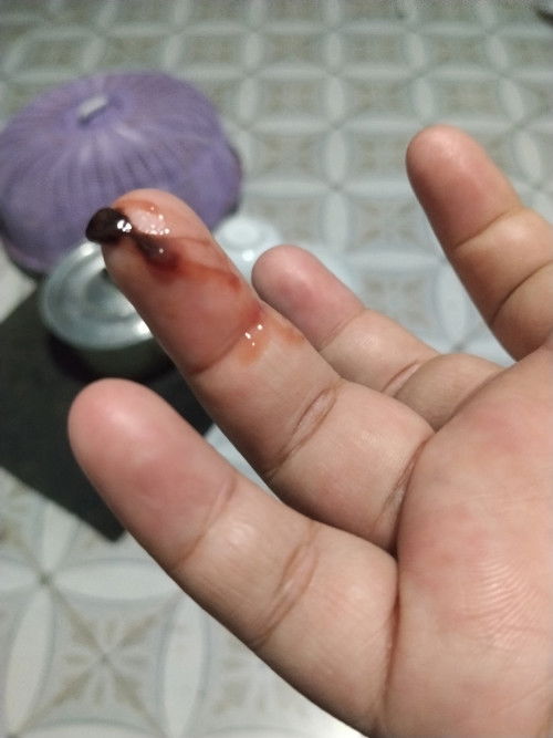 38+6มีเลือดออกมาแบบนี้เรียกว่ามูกเลือดใช่ไหมคะออกมานิดหน่อยแบบนี้ต้องไปรพไหมคะ