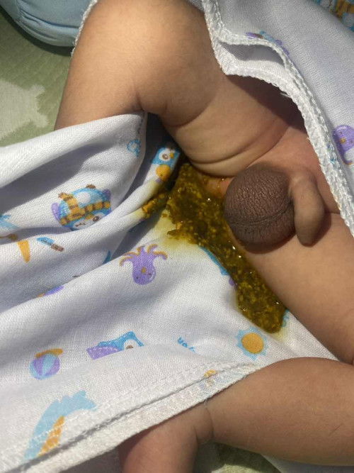 อึแบบนี้ปกติมั้ยคะ