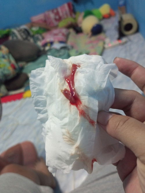 ตั้งครรภ์38wโดนกระตุ้นปากมดลูกแล้วมีแบบนี้ออกมาควรไปหาหมอไหม