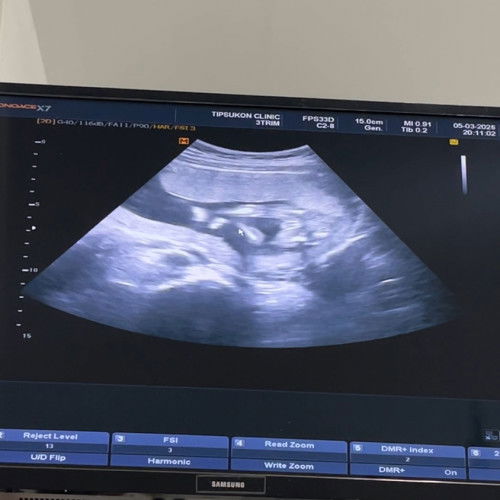 คิดว่าเป็นหญิงหรือชาย