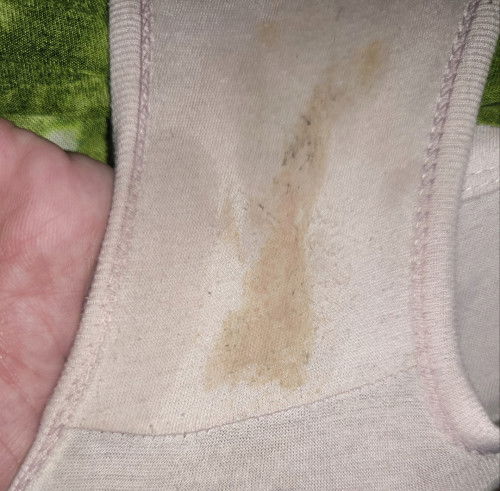 Mga mi, ano po kaya ito, 31 weeks pregnant na po ako pag gising ko po meron ako neto.