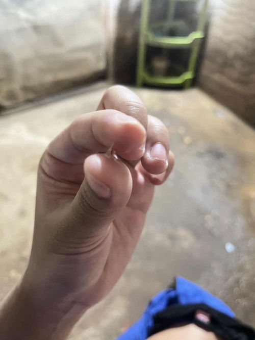 สอบถามค่ะ ท้องแรกค่ะ