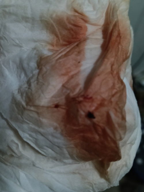 สอบถามหน่อยค่ะ ตั้งครรภ์18+3