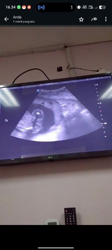 JK cewek atau Cowok?