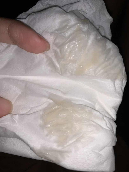 flek atau keputihan?