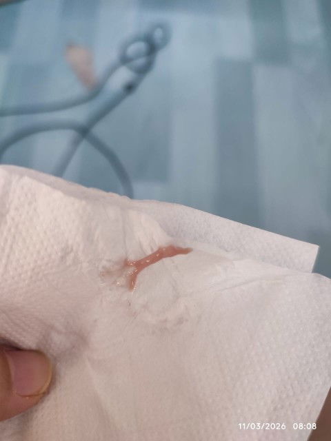 Spotting bleeding or keputihan??