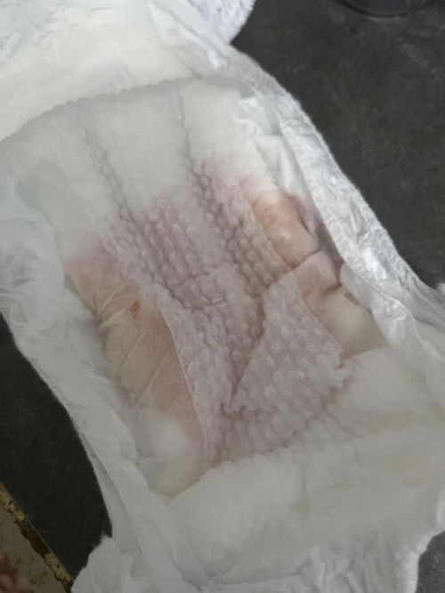 baby lelaki 1 tahun 10 bulan