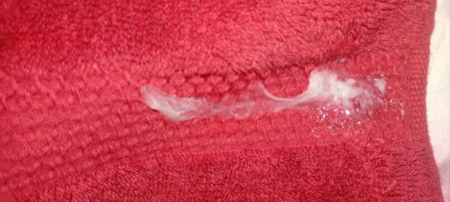 hi genuinely asking, is this normal?  im in 29weeks day 5, it's my 2nd day na nilabasan nang ganito,