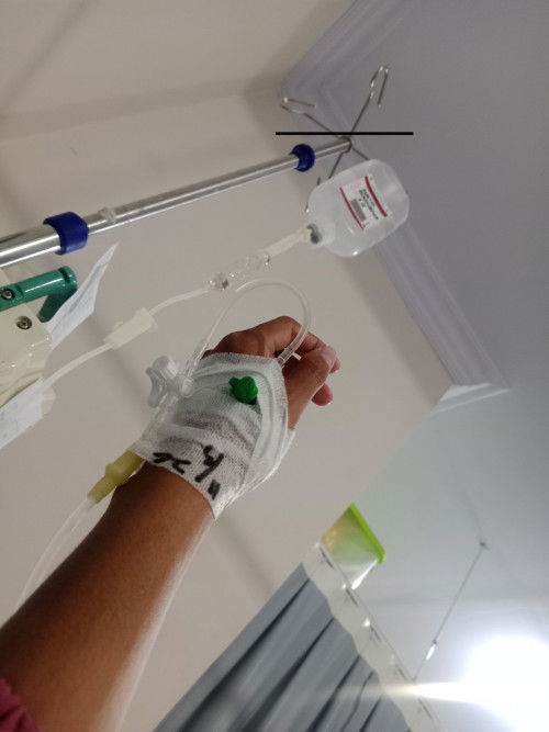 Trauma hal bolak balik RS