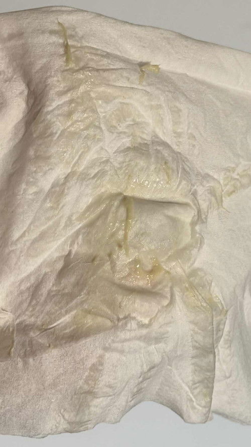 ตกขาวสีแปลกๆ