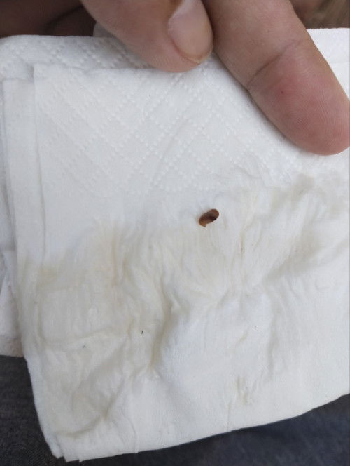 สอบถามหน่อยค่ะ ต้องไปหาหมอไหมคะ แต่ไม่ปวดท้องคะ