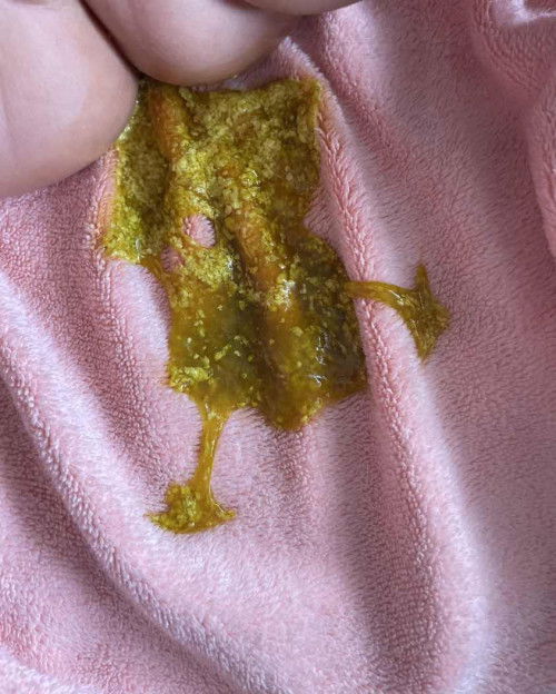 สอบถามแม่ๆหน่อยค่ะ