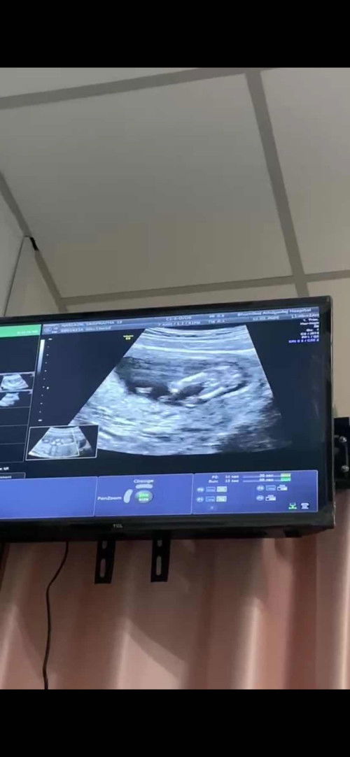 แบบบนี้จะได้ลูกสาวหรือลูกชายคะแม่ๆ