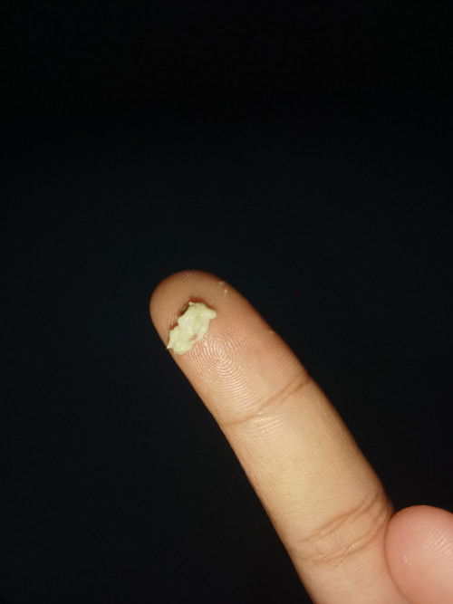 ตกขาวสีเขียวอ่อนตอนท้อง20วีคเป็นอันตรายไหม